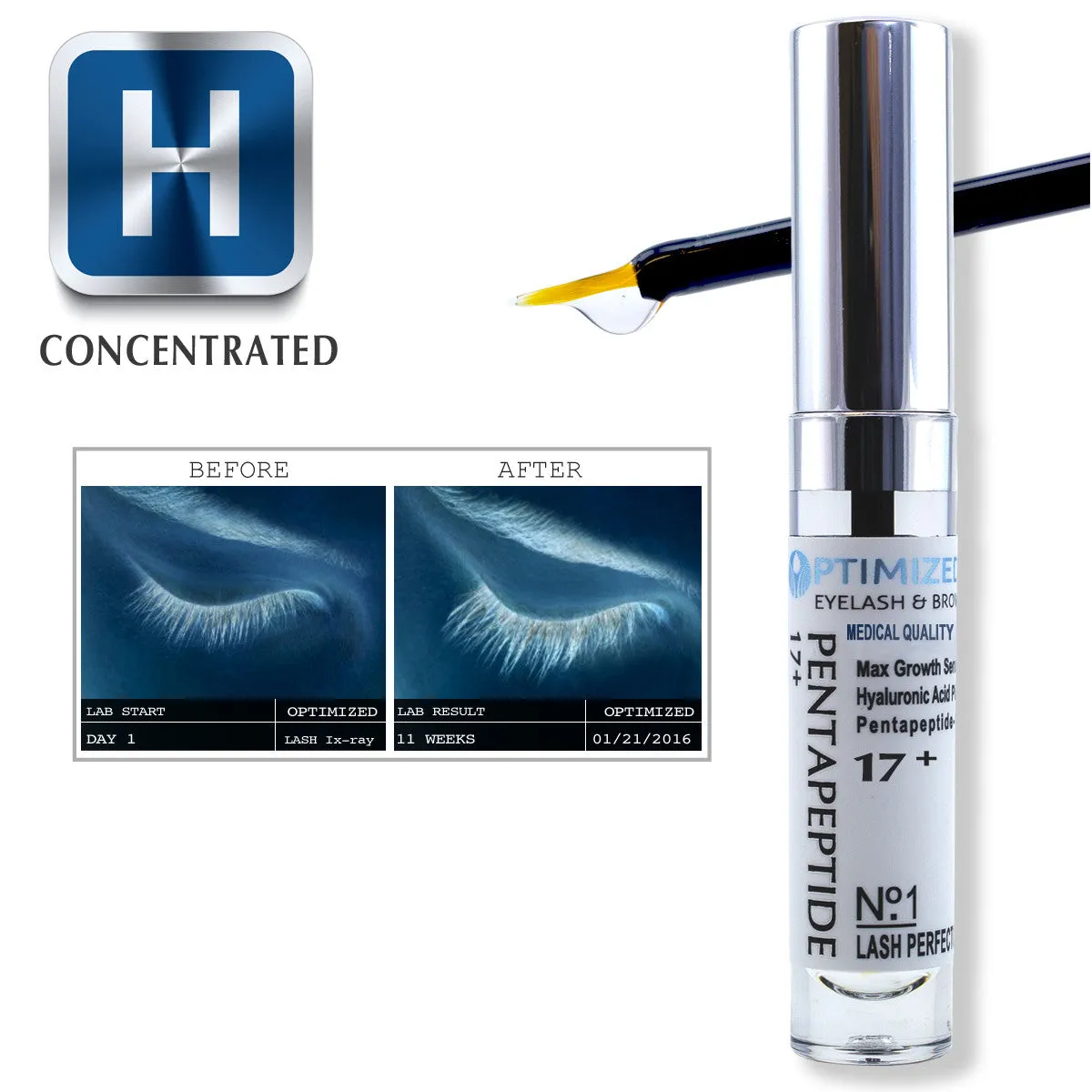 OPTIMIZED Pentapeptide 17 & Hyaluronic Acid Max Strength Growth Serum