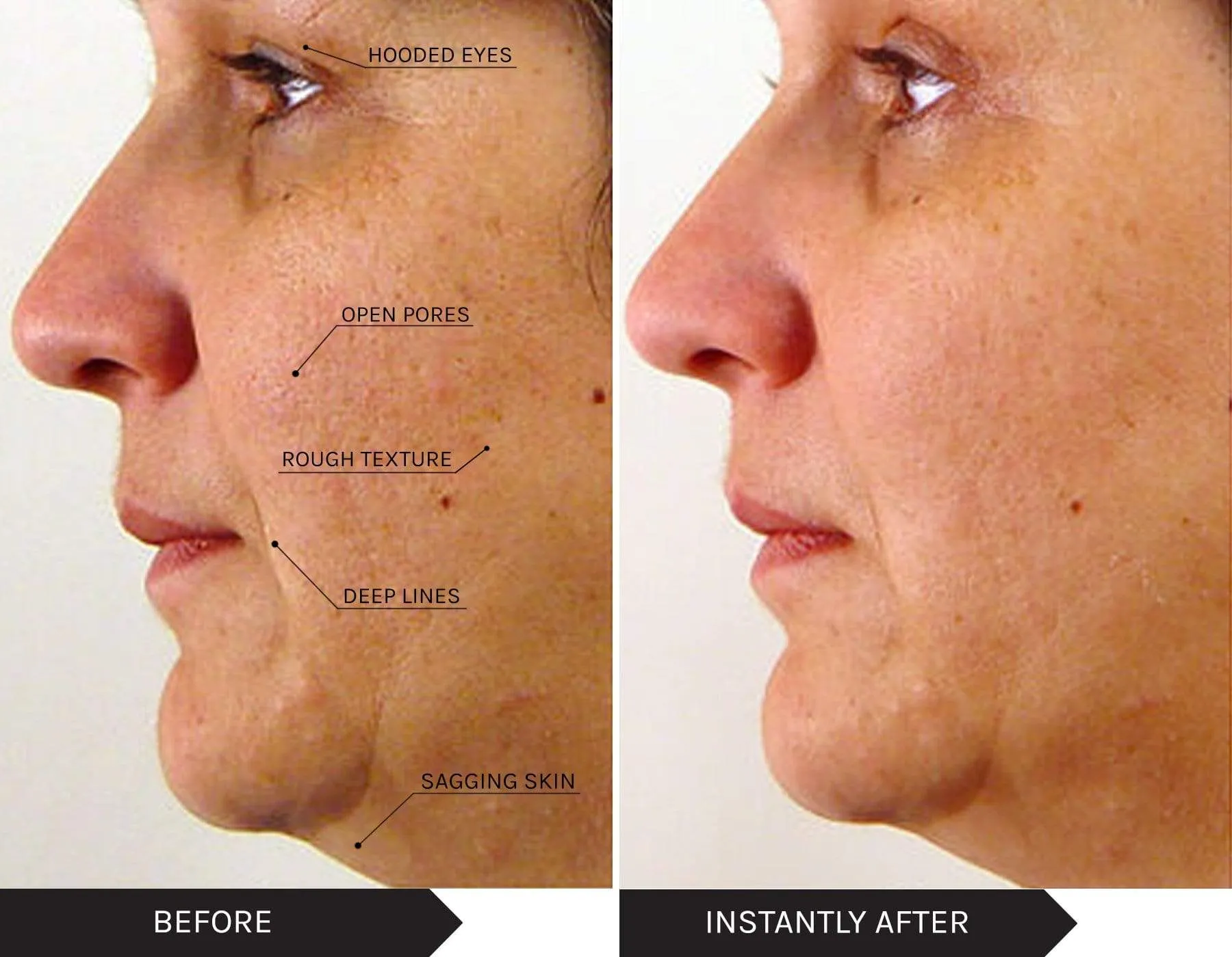 Skin Routine - Target Dry Skin